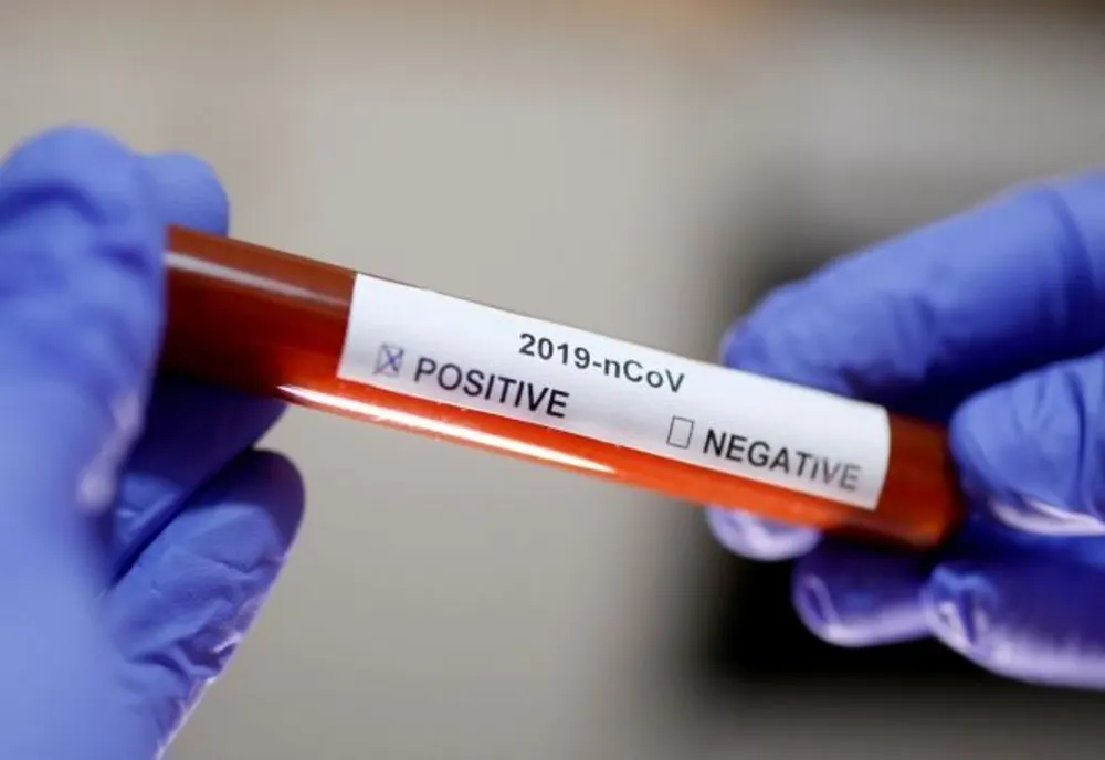 Focar de coronavirus la IPJ Ialomița