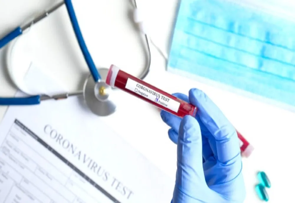 Coronavirus la Primăria Slobozia