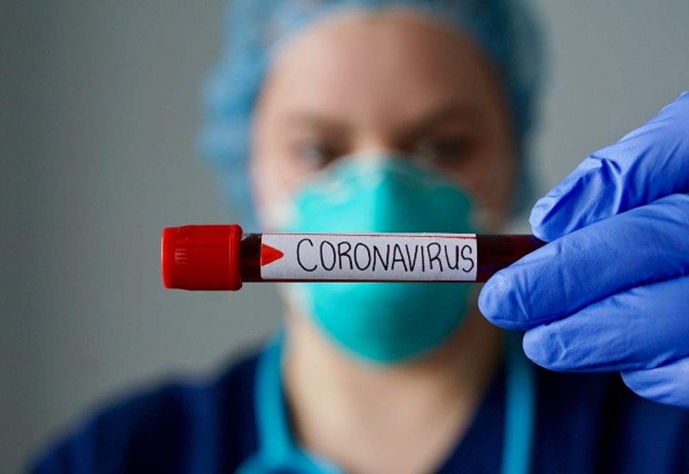 20.604 cazuri de persoane infectate cu virusul COVID – 19 în România