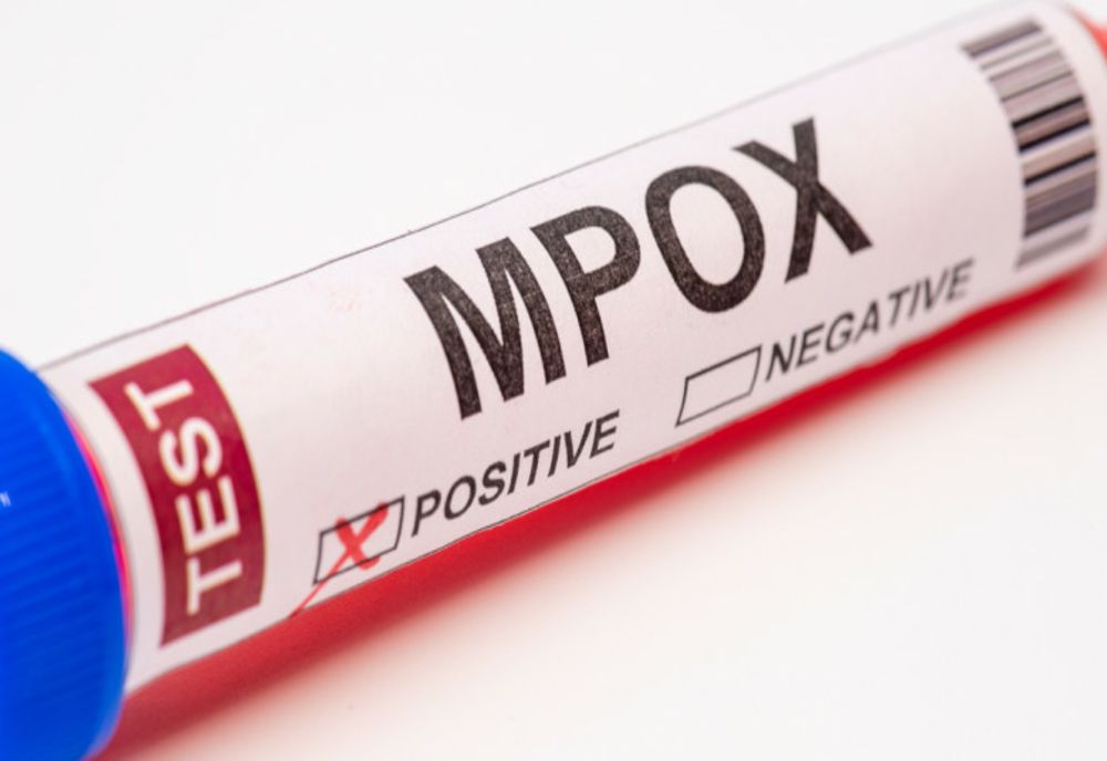 GERMANIA RAPORTEAZĂ PRIMUL CAZ DE MPOX