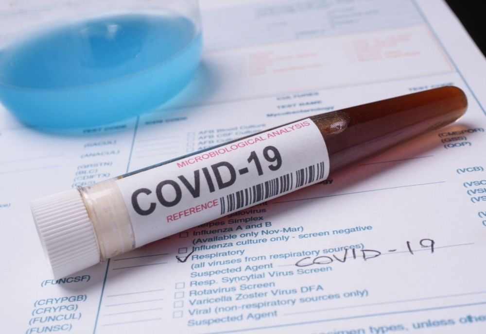 119 cazuri noi de infectare cu coronavirus în România. Cel mai mic număr din ultimele două luni