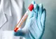 Un nou caz de coronavirus confirmat în Ialomița