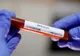 Bilanț coronavirus 14 ianuarie: 9.884 cazuri noi și 30 decese